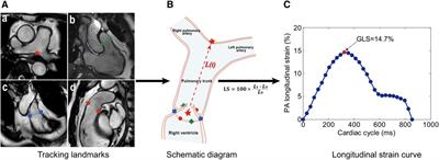 Characteristics of pulmonary artery strain assessed by cardiovascular magnetic resonance imaging and associations with metabolomic pathways in human ageing